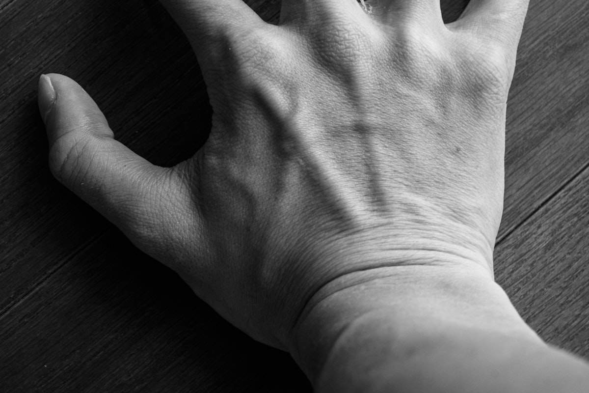 Ganglion — illustrative image